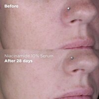 SKIN REPUBLIC Niacinamid 10% Serum 30ml – Porenverfeinerung